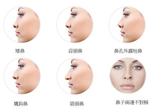 人的鼻子有哪些作用?