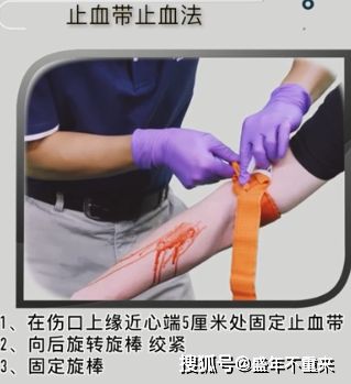 使用止血带止血时不能采取什么措施?