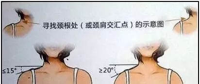 溜肩和正常肩的区别图片，溜肩百度百科