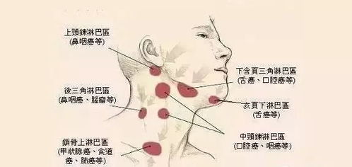 淋巴是什么器官，淋巴是什么组织