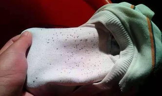 黑色发霉的衣服用什么洗能洗掉，发霉的衣服用什么洗能洗掉流鼻涕打喷嚏能不能吃泰诺