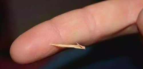 手里扎刺怎么办?