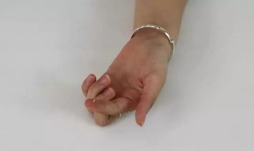 手上扎了刺取出窍门视频，手上扎了刺如何取出