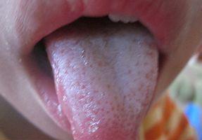 舌苔怎么看湿气重，舌苔怎么看有没有上火