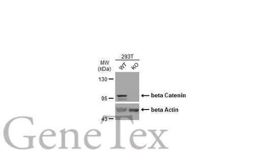 :β-catenin基因第3外显子呈突变型 什么病