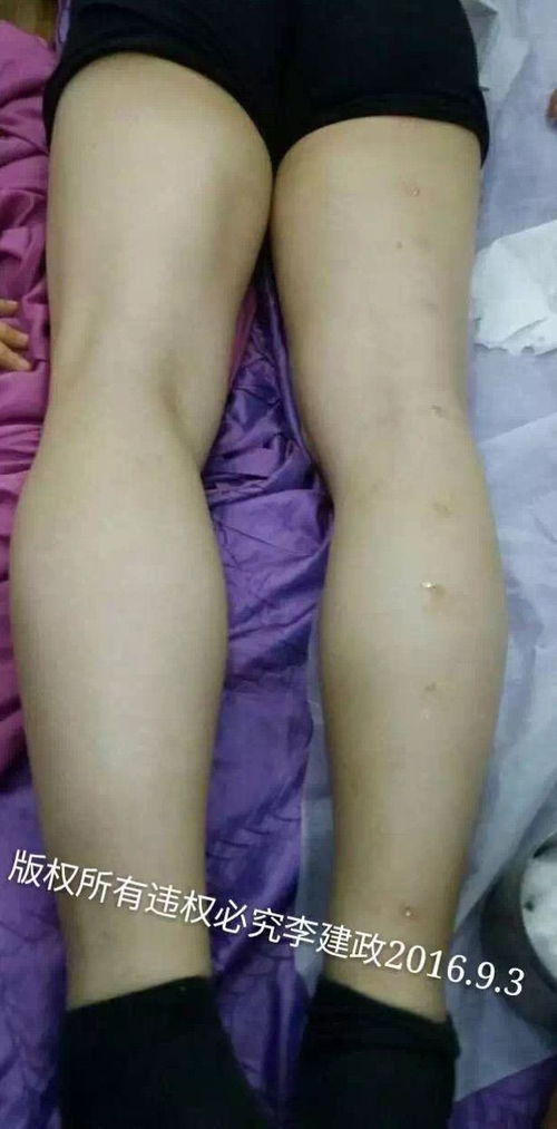 银针秀讲故事:东施效颦 春秋时代,越国有一位美女名叫西施。她的美貌简直