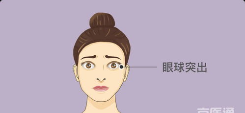 炯炯有神意思