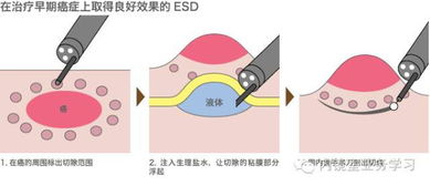 抬举的近义词是什么