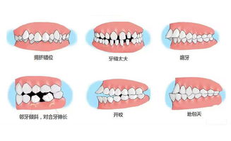 齿序排班意思是什么，齿痛消炎灵颗粒治牙疼效果