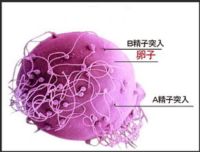 试管婴儿lcsl是什么意思