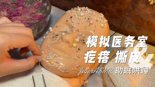 疙瘩的读音