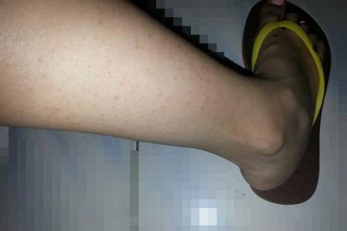 数字成语什么毛什么角
