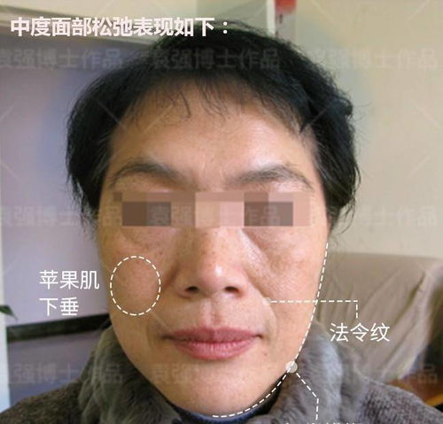 耷拉的意思耷拉怎么读