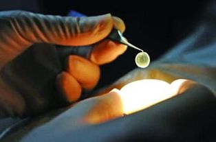 眼角膜是什么症状，眼角膜是什么构成的