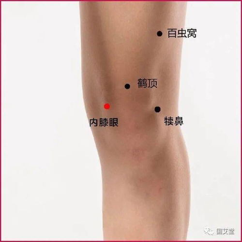 犊鼻_的读音犊鼻_的读音是什么