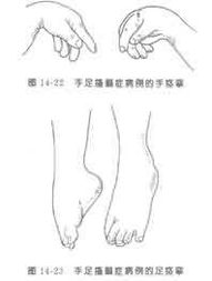 搐字组词