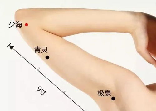 挛怎么读