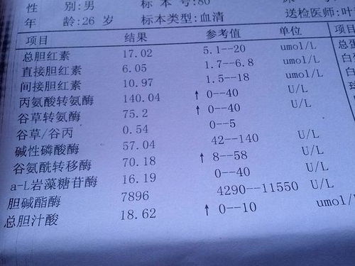 谷丙转氨酶是什么意思