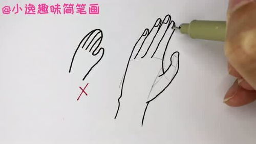 手的部位图及名称图解，手的功能位和休息位
