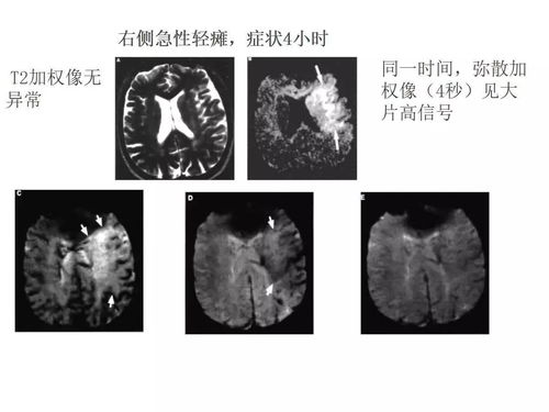 头颅的意思和读音，自言自语的意思