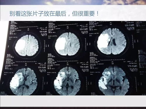 头颅的意思