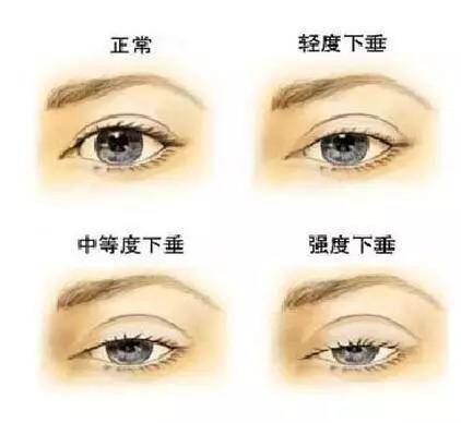 眼睑的读音、拼音、笔顺是什么?