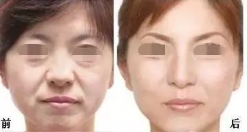 皱巴巴是什么意思
