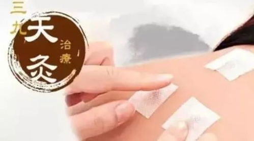 古籍中的天灸简介
