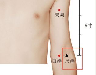 曲泽放血的功效与作用，曲泽的准确位置图视频