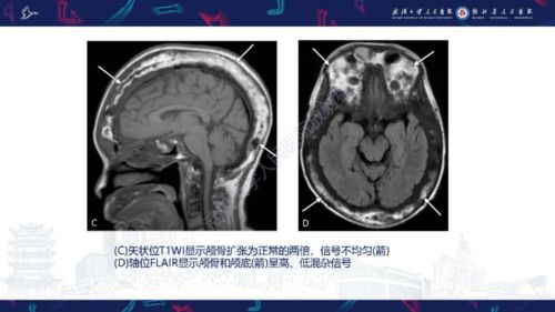 累及是什么意思