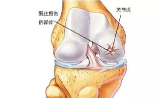 累及是什么意思，累及的读音
