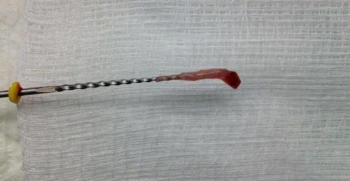 髓怎么读