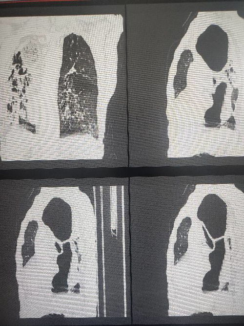 憋闷的意思