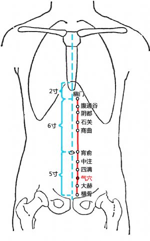 气穴现象