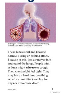 asthma翻译，asthma词根词缀