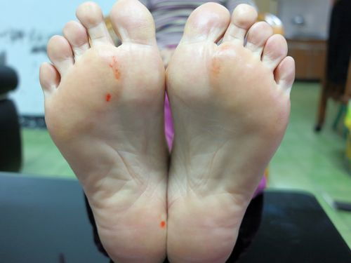 香港脚是什么意思?猜生肖，为什么脚臭叫香港脚