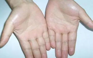 从掌纹看健康女生，从掌纹看健康书籍
