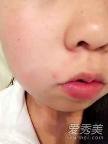 嘴里长痘打一字，嘴巴长痘猜一个字
