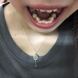 正颌正畸是什么意思，牙齿修复正畸是什么意思