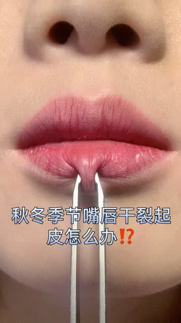 唇纹很深如何能消除，唇纹是什么