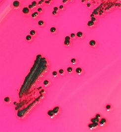 salmonella enterica，salmonella group