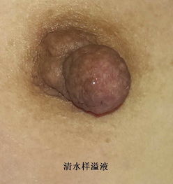 溢怎么读，溢的意思