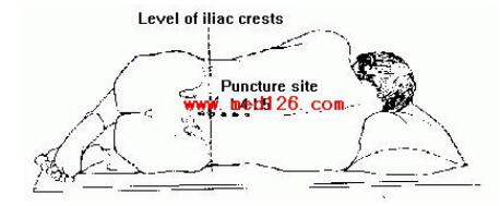 lumbar puncture，lumbar spine的意思