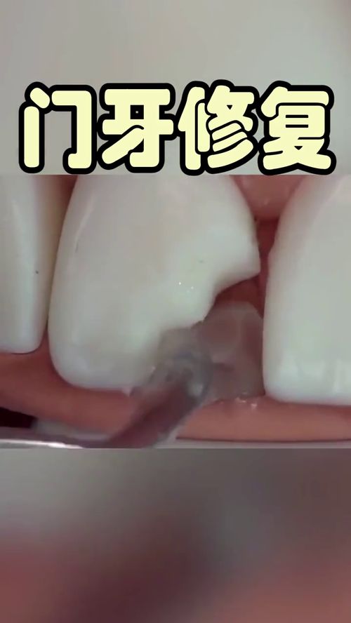 什么叫蛀虫?