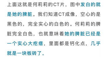 密密麻麻的反义词语，仰望的反义词