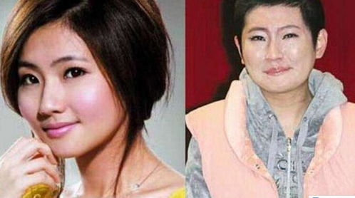 张承中娶了“毁容”的Selina后,为何又狠心离婚?