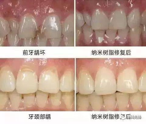 嵌入的意思，寸寸镶嵌的意思