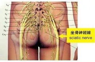 神经痛怎么办?