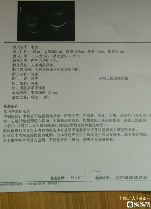 庞大的反义词庞大的反义词是什么