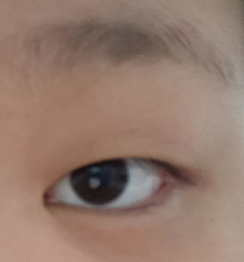 对子眼怎么矫正，对子眼看东西是啥样的